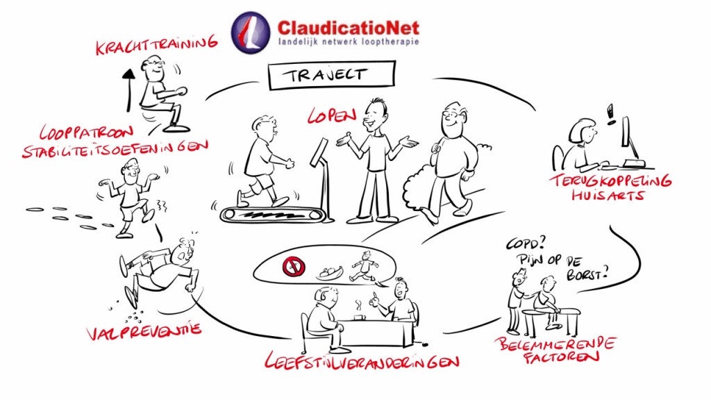 claudicationet traject